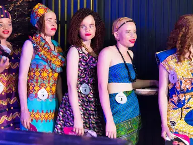 Kontestan berada dibelakang panggung bersiap mengikuti kontes kecantikan Miss Albino di Harare,  Zimbabwe (17/3). Zimbabwe menggelar kontes kecantikan bagi wanita albinisme atau albino. (AFP Photo/Jekesai Njikizana)