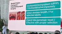 Dokter: Mendengkur Bukan Pertanda Tidur Nyenyak