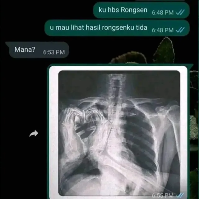 6 Chat Prank Sakit ke Teman Ini Kelewatan Tapi Kocak, Sukses Bikin Panik