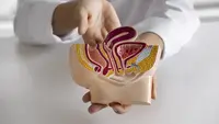 Dokter Ungkap 5 Pola Makan dan Gaya Hidup yang Bisa Picu Wasir atau Ambeien