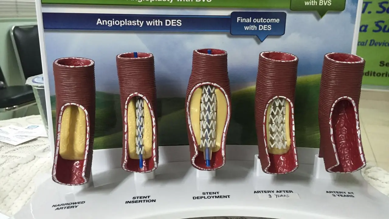 Bioresorbable Vascular Scaffold