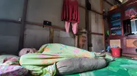 Nur Hindra (38), warga Kutai Kartanegara hanya bisa berbaring di ruang tamu rumahnya sambil menahan sakit akibat kulitnya yang terus mengelupas.
