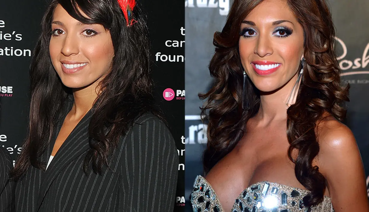 Farrah Abraham tak malu mengaku melakukan operasi hidung. Dia bahkan mengucapkan terima kasih pada dokternya secara terang-terangan. (Celebrity Plastic Surgery)