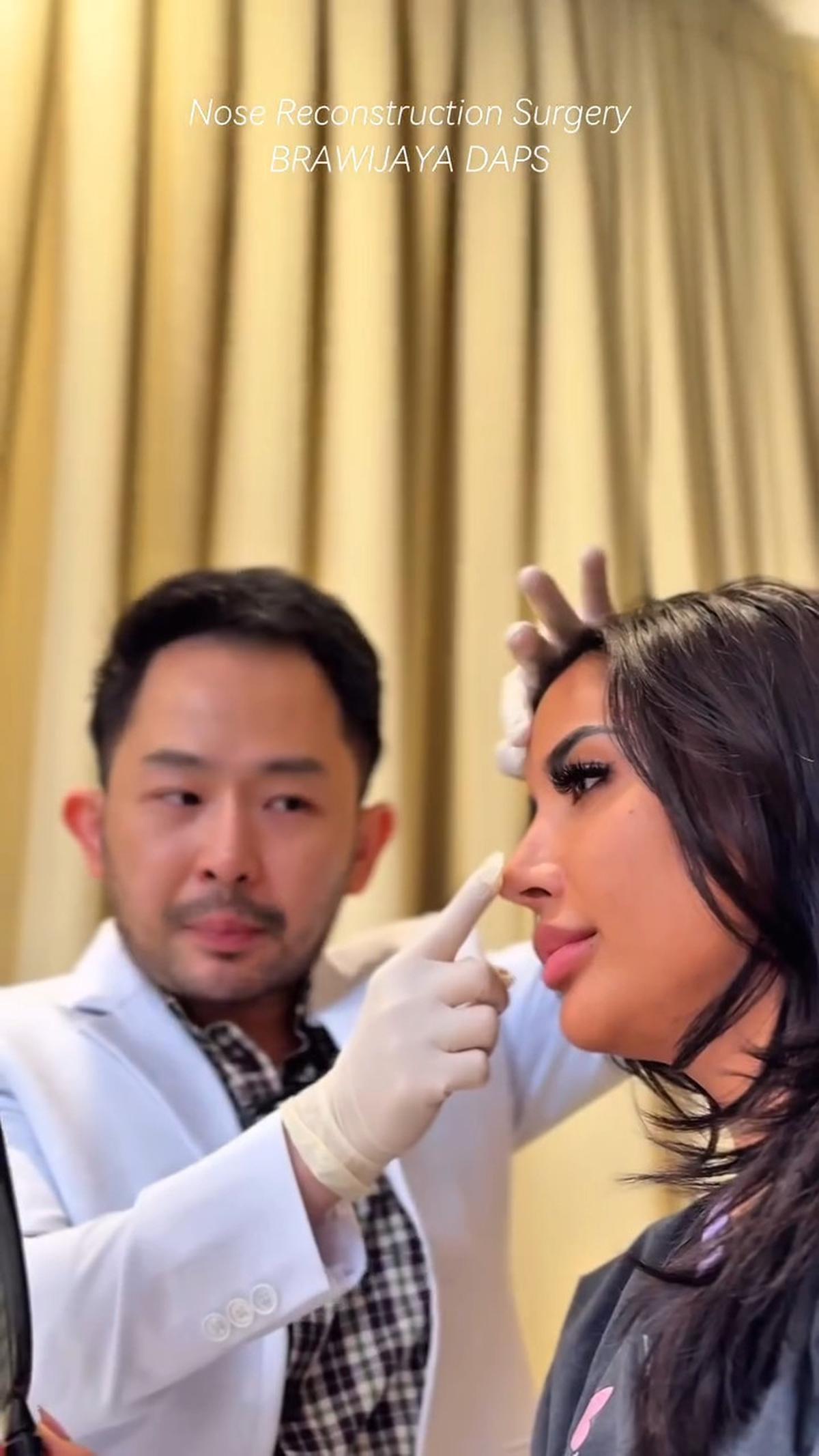 Millen Cyrus Mau Rombak Hidung Lagi, Netizen: Udah Cantik Mau Diapain Lagi?