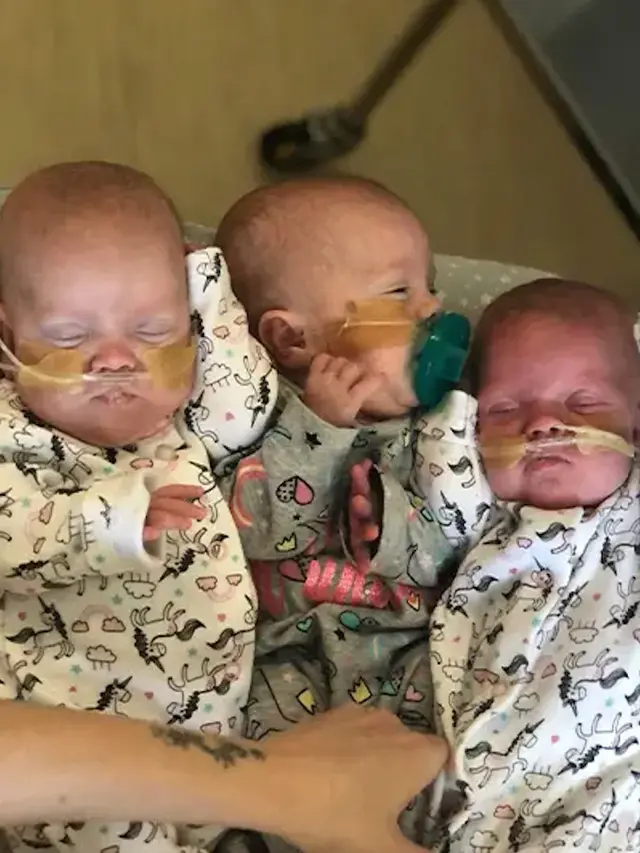 Bayi Kembar Tiga Paling Prematur
