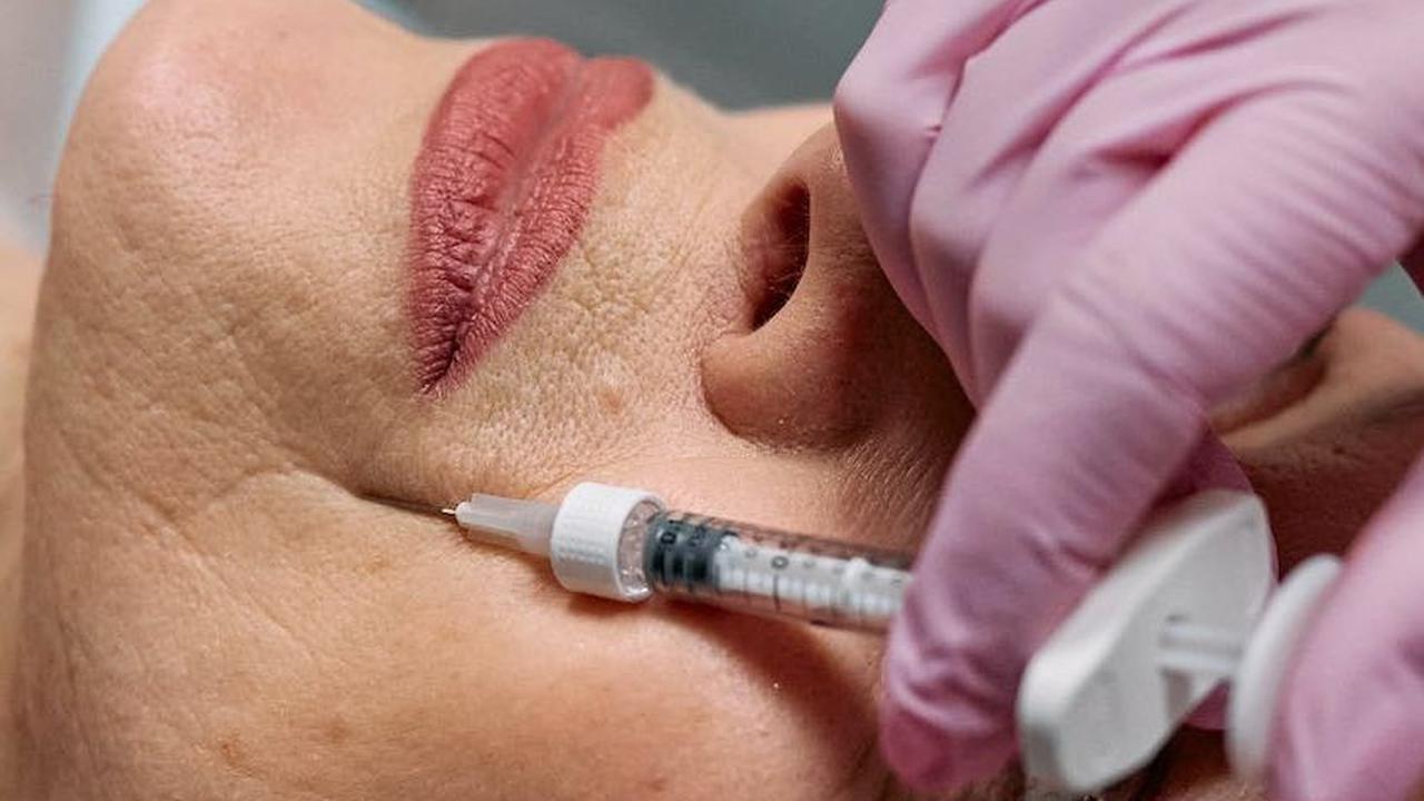 Tak hanya botox, untuk menghilangkan kerutan juga bisa dengan menggunakan metode filler. Yaitu prosedur kosmetik dengan menyuntikkan bahan sintetis atau ke garis, kerutan dan jaringan wajah.