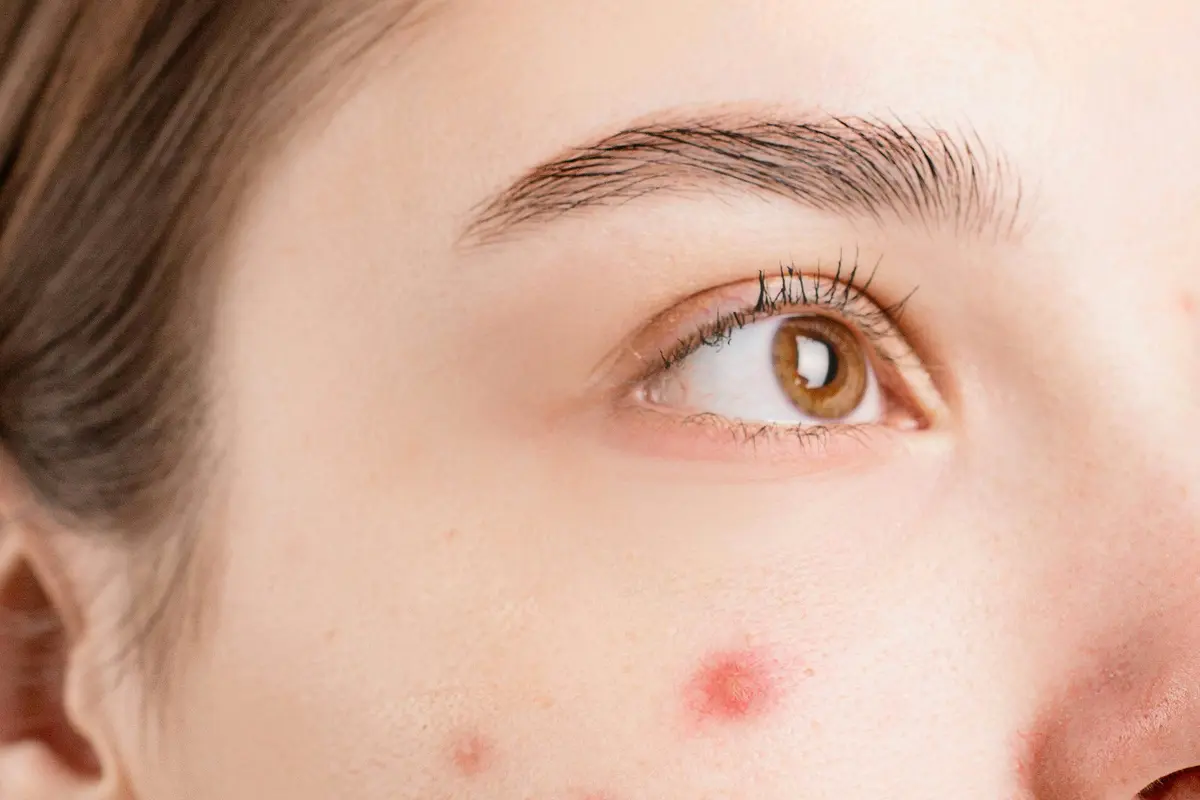 Panduan Memilih Sunscreen Sesuai Jenis Kulit (photo by pexels.com)