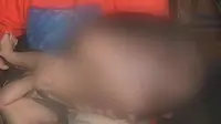 Bayi Penderita Hidrosefalus di Bandung Butuh Uluran Bantuan