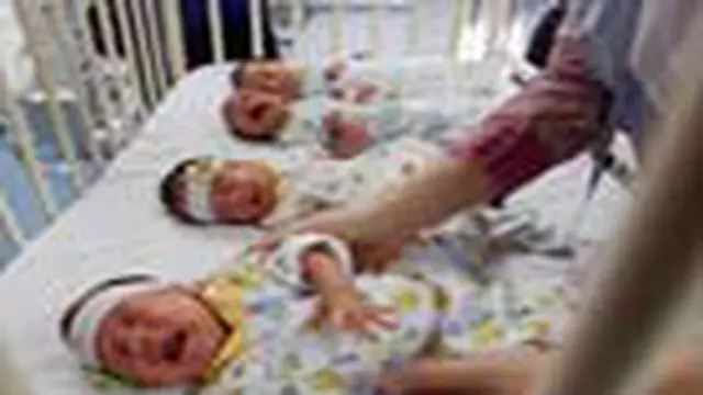 Bayi Kembar Empat Lahir Prematur