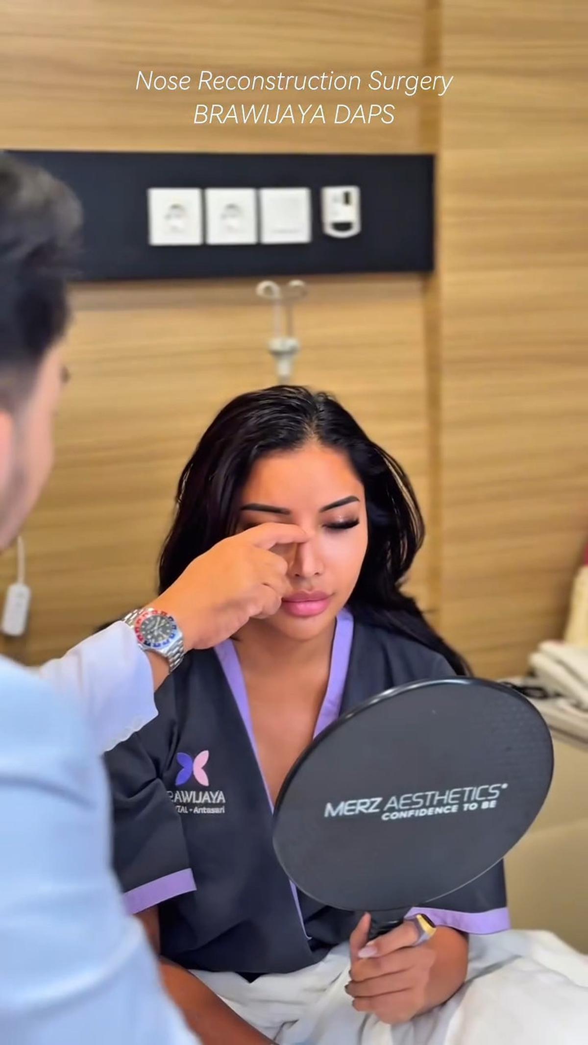 Millen Cyrus Mau Rombak Hidung Lagi, Netizen: Udah Cantik Mau Diapain Lagi?