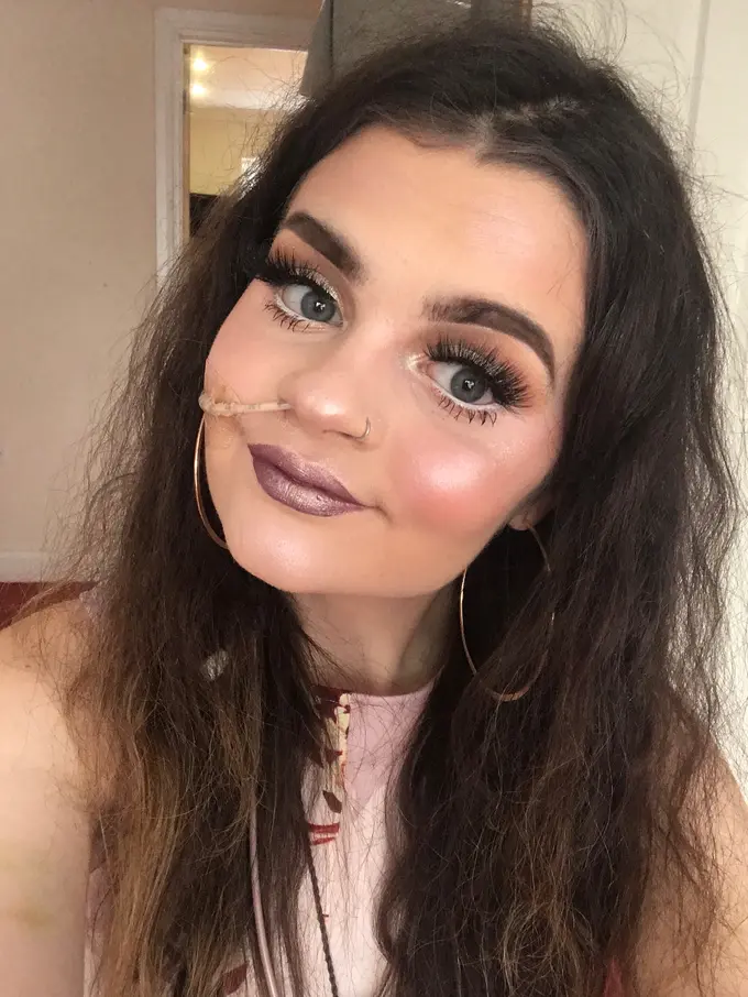 [Fimela] Kisah beauty vlogger yang harus menggunakan selang makanan seumur hidup