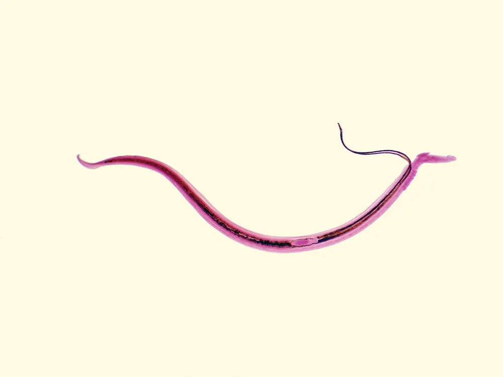 Mengenal Schistosomiasis, Infeksi Cacing yang Mematikan (Jubal Harshaw/ Shutterstock)