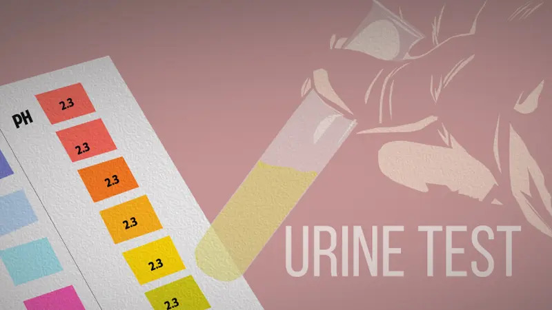 Ilustrasi Tes Urine 