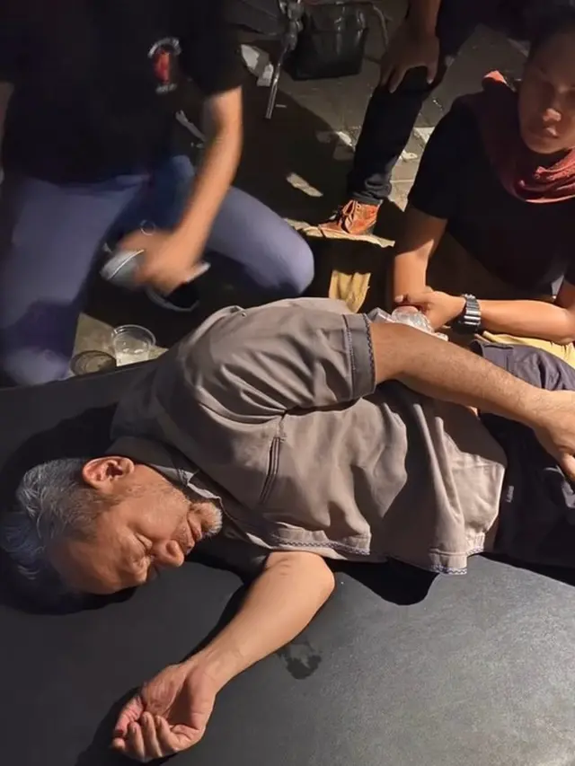 Indra Brasco cidera (Instagram/monaratuliu)