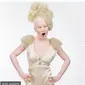 Cerita Wanita Albino Xueli Abbing Pernah Dibuang di Panti Asuhan Kini Jadi Model Terkenal. (dok.Instagram @flaviadutradermato/https://www.instagram.com/p/COTE8NAF5H4/Henry)