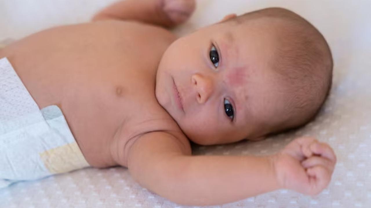 Ruam Popok (Diaper Rash)