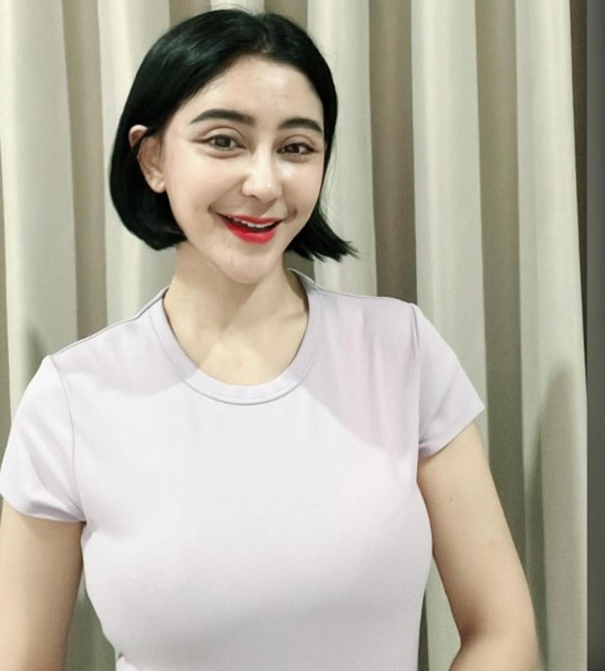 Potret Transformasi Uut Permatasari Setelah Operasi Plastik di Korea, Merasa Terlihat Lebih Muda