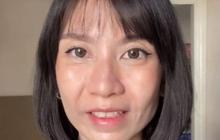 Viral Curhatan Wanita yang Gagal Suntik Botox, Bikin Tak Bisa Tertawa selama Empat Bulan