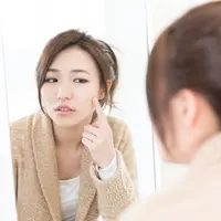 Ilustrasi jerawat/copyright shutterstock