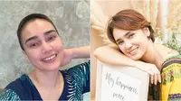 6 Potret Terbaru Feby Febiola Usai Jalani Kemoterapi, Kini Botak