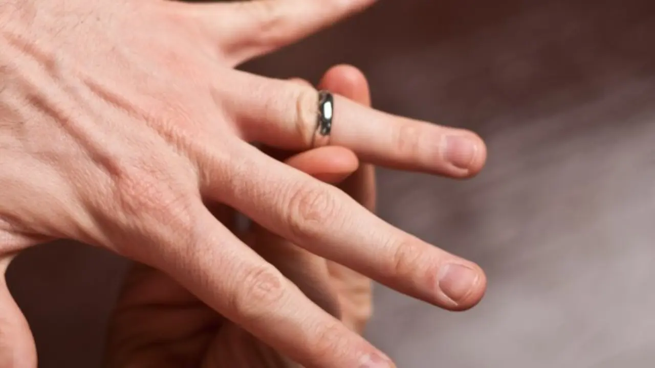 Begini Selamatkan Nyawa dari Cincin yang Terjebak di Jari