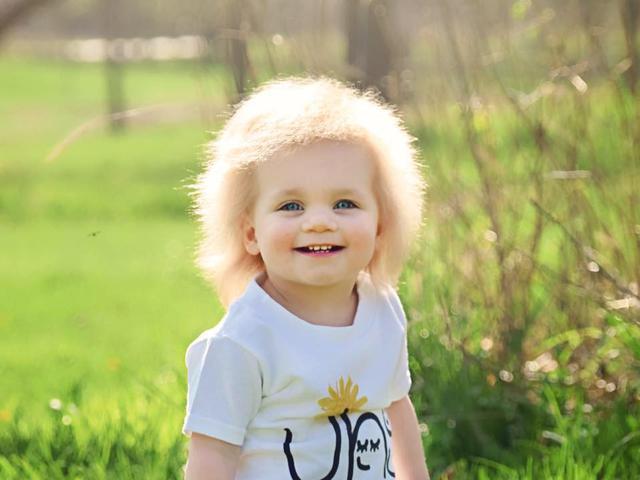 Bayi Lucu Ini Punya Rambut Jabrik Mirip Albert Einstein Health Liputan6 Com