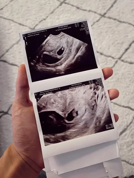 Dinda Hauw (Instagram/dindahw)