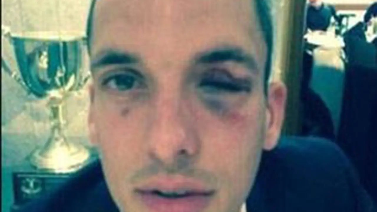 Leon Osman