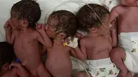 Bayi Kembar 7 Lahir di Meksiko