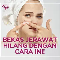 Jerawat dan bekas jerawat merupakan masalah kulit yang paling sering dialami. Nah, berikut cara menghilangkan jerawat dan bekas jerawat dalam satu hari. Simak video selengkapnya!
