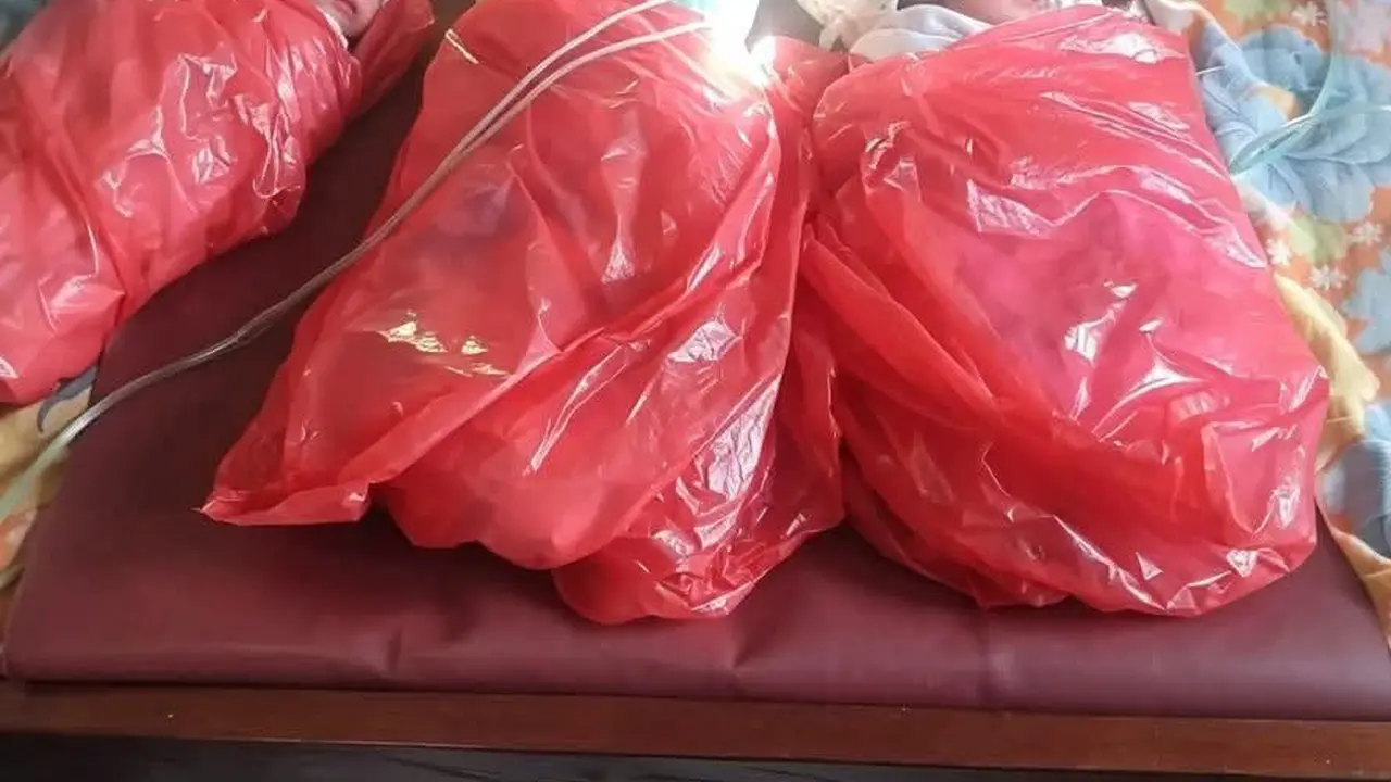 Bayi kembar tiga di Flores Timur NTT