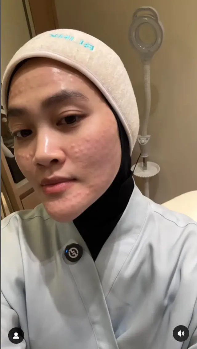 6 Potret tranformasi wajah Henny Rahman istri Alvin Faiz usai perawatan, berubah glowing dan mulus