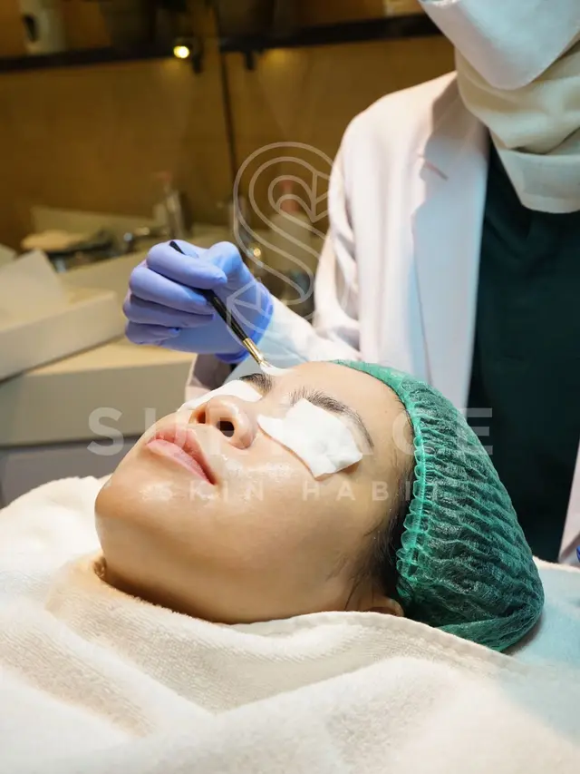 Perawatan medis untuk Meratakan Warna Kulit