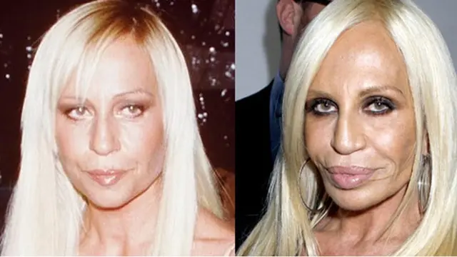 Donatello Versace