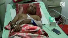 Mas'hud berhasil selamat setelah sebelumnya setengah jam berduel dengan buaya saat hendak memancing.