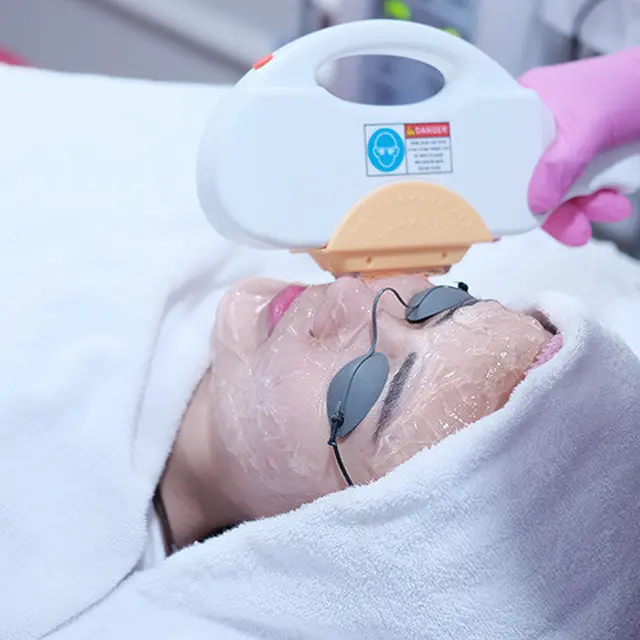 Perawatan IPL/dok. Klinik Airin