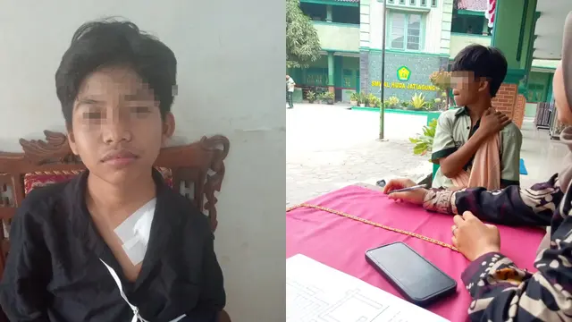 Pelajar SMP di Lampung Selatan Diduga Dibully Teman hingga Bahu Patah, Harus Operasi Pasang Pen