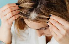 Cara Mengatasi Rambut Pitak  dengan Trik Makeup yang Mudah dan Praktis