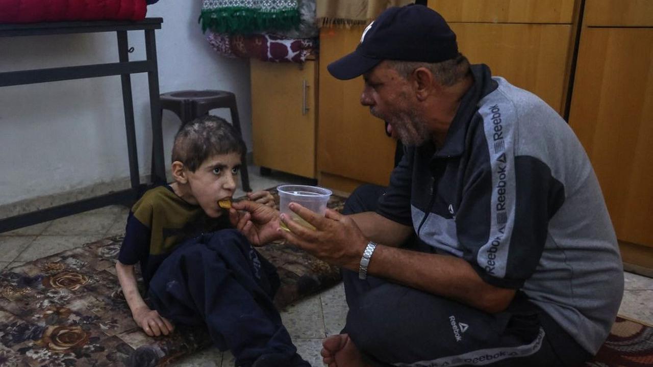 <b>PBB: 50.000 Anak Gaza Butuh Perawatan karena Kekurangan Giz</b>