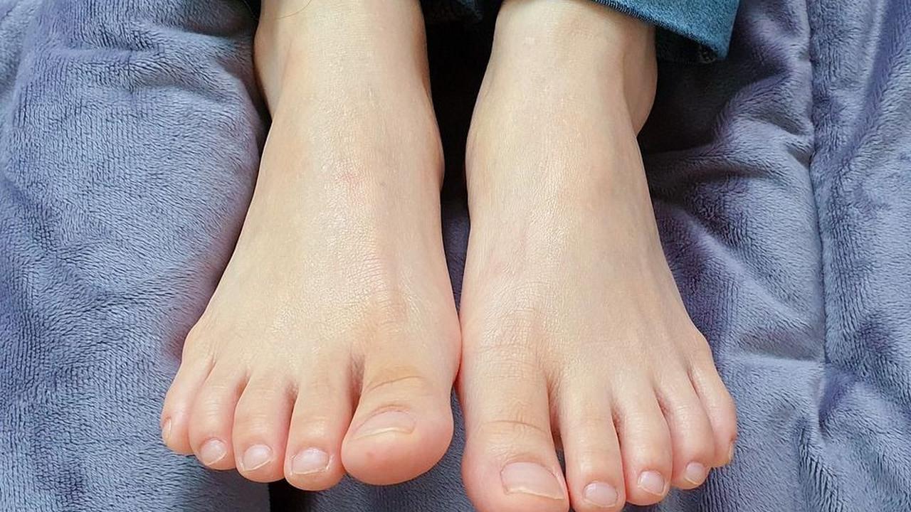 Penyebab Mata Kaki Hitam