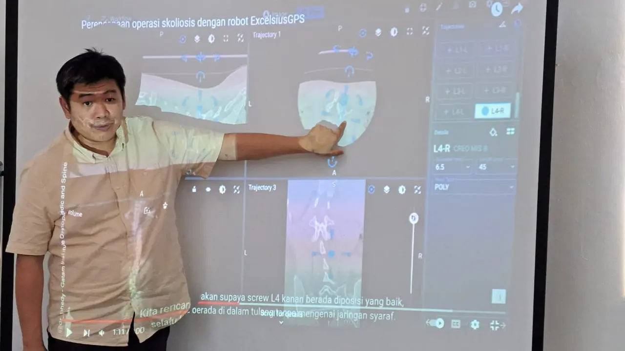 Kenali Scoliosis Postural atau Palsu, Bisa Dicegah dengan Pola Hidup Sehat