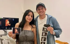 Andrew Andika Siap Sambut Kelahiran Anak Perempuan, Ungkap Alasan Pilih Operasi Caesar