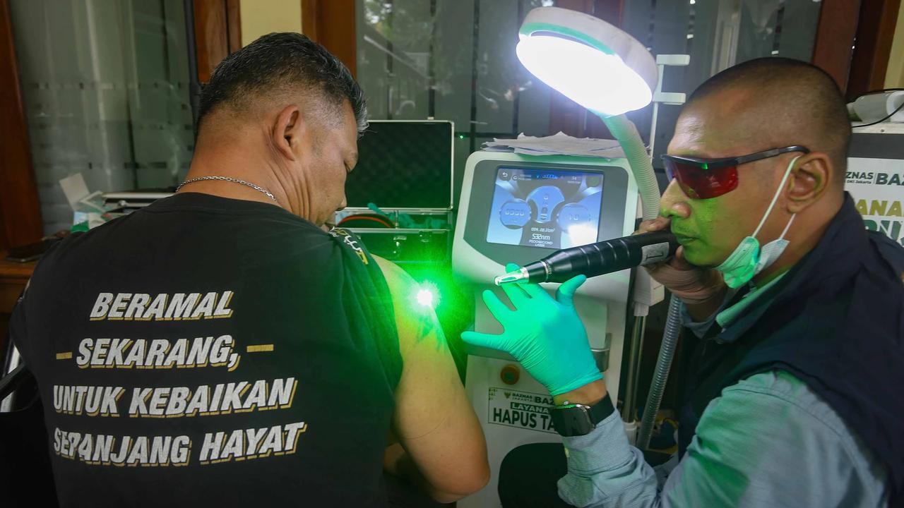 FOTO: Layanan Hapus Tato Gratis Sambut Ramadhan di Jakarta