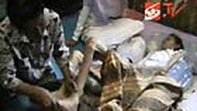 Menderita Penyakit Aneh, 10 Tahun di Kasur