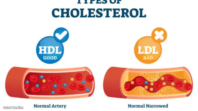 Kolesterol HDL dan LDL