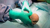 Pertama Kali, Bayi Monyet Lahir Lewat Cesar Mirip Voldemort