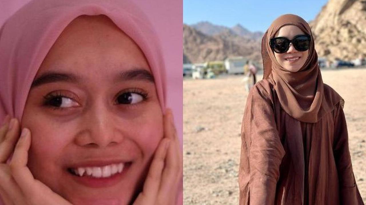Lesti Kejora juga memutuskan untuk menghilangkan gigi gingsulnya dengan menggunakan behel agar struktur giginya lebih rapi.&nbsp;