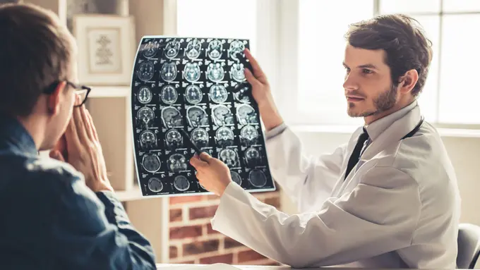 Metode Digital Subtraction Angiography mampu deteksi kelainan otak (VGstockstudio/Shutterstock)