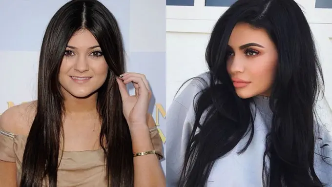 Perubahan Kylie Jenner Dulu dan Sekarang, Mana yang Lebih Menarik?