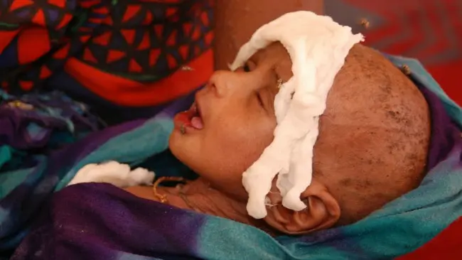 Ilustrasi bala kelaparan Somalia, September 2011. (Sumber Wikimedia Commons/VOA)